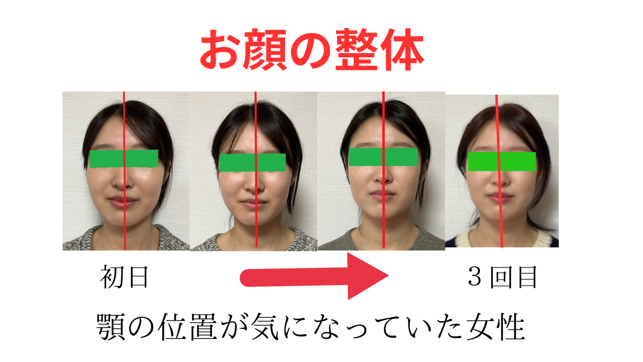 お顔の骨格調整